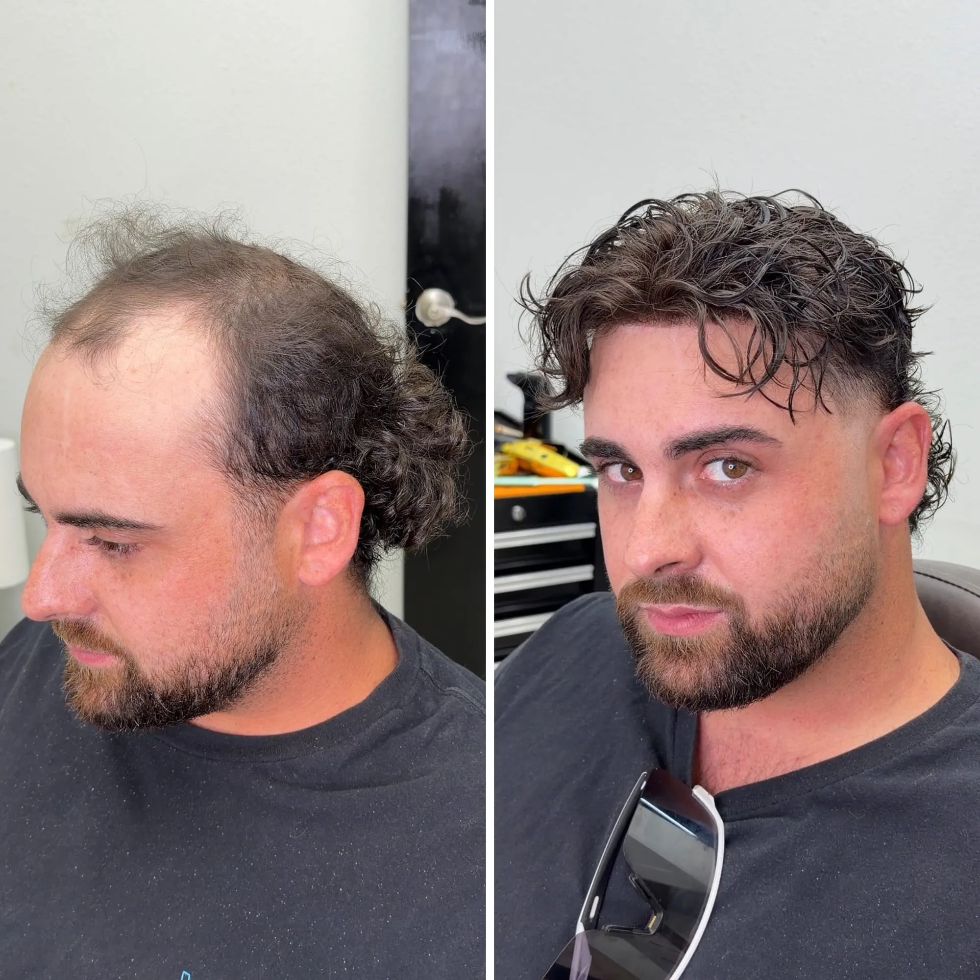 Before and after: a bearded client with a receding hairline, then with thick dark curly hair blended into a fresh cut after his hair system install.