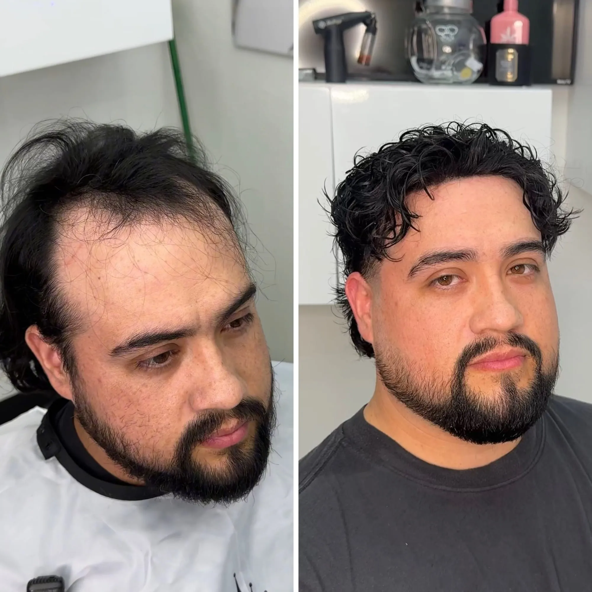 Before and after: a client with thinning hair on top, then with a full dark textured crop after a custom hair unit was fitted and blended.