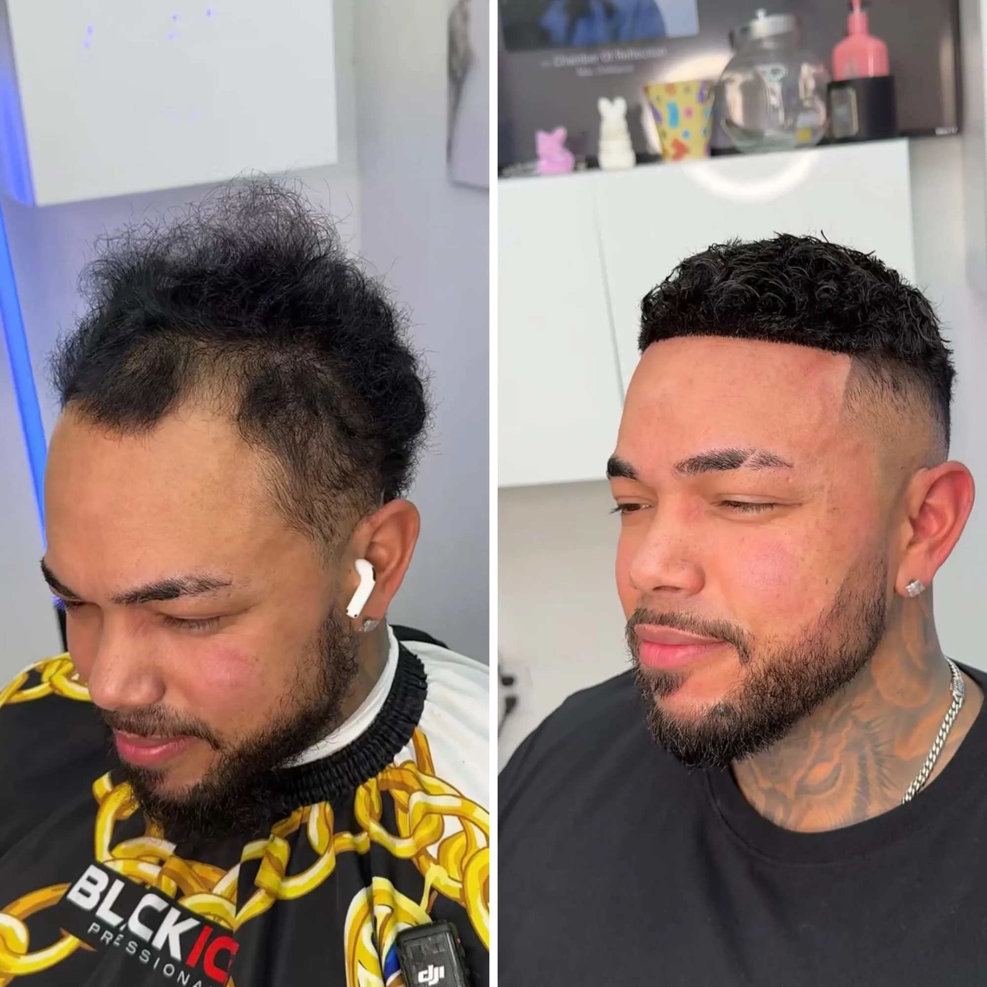 Before and after: a client with noticeable thinning, then with a dark textured cut and a sharp fade following his hair replacement.