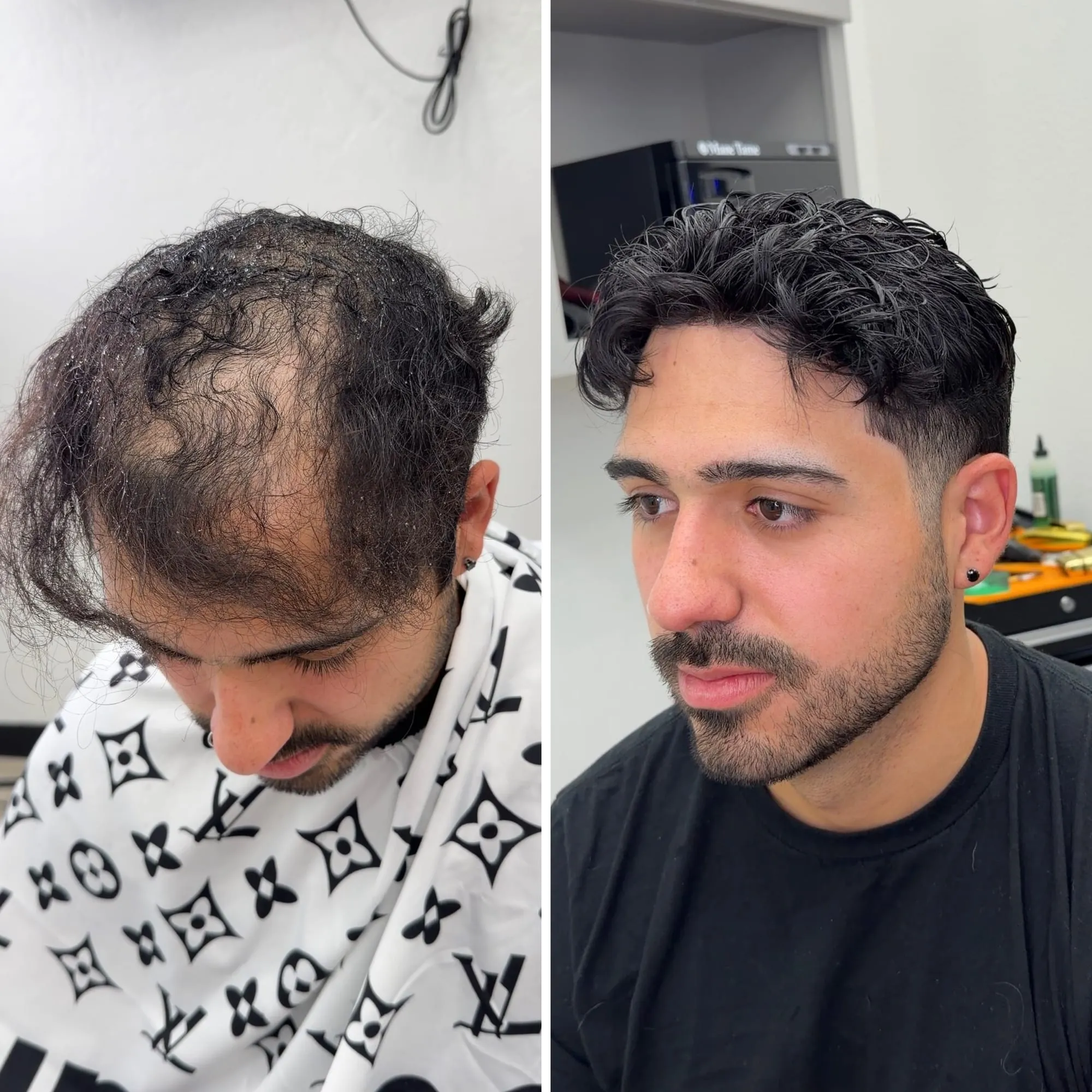 Before and after: a client with significant thinning through the crown, then with full dark textured hair after a hair system install at the studio.