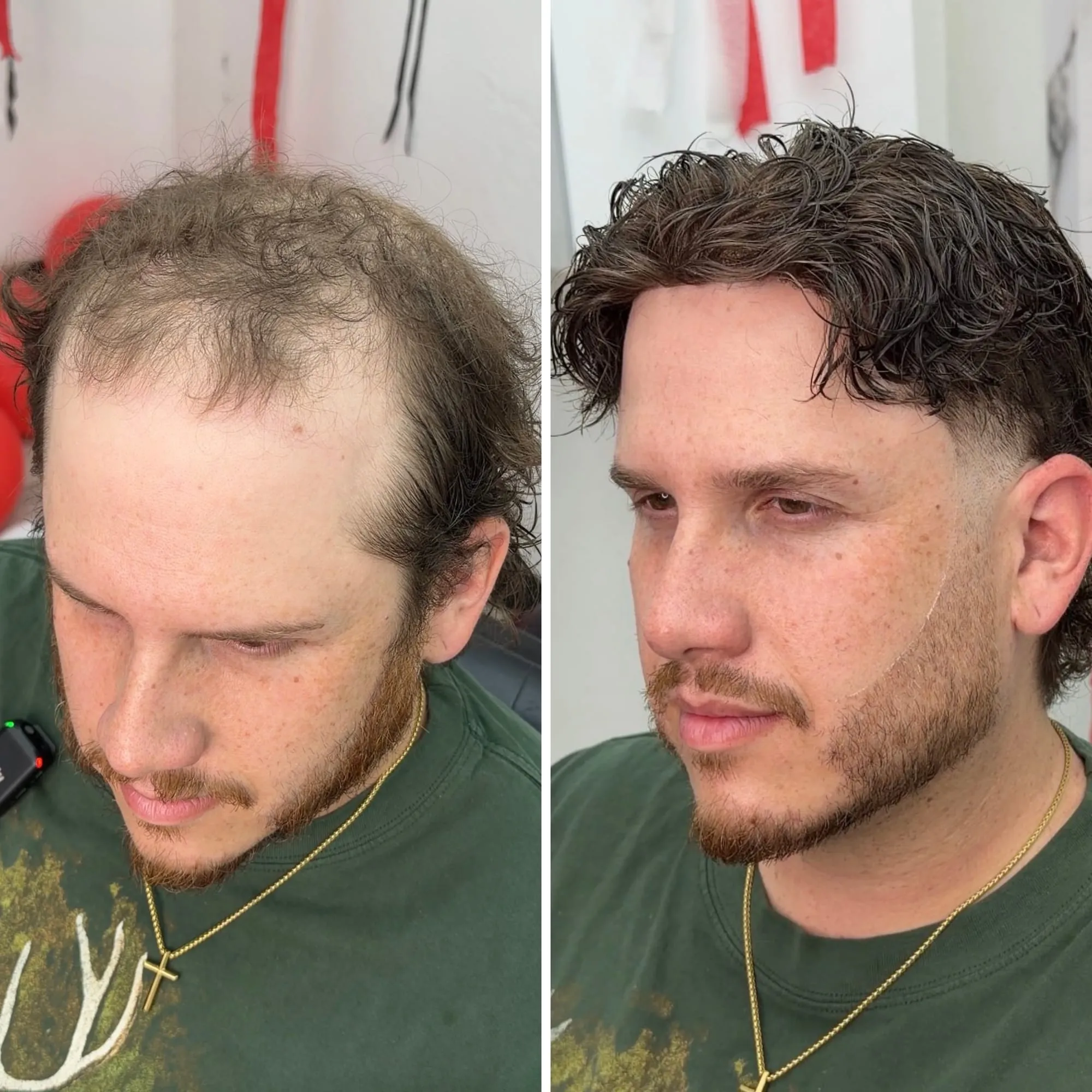 Before and after: a client with light thinning hair, then with fuller dark curls cut and blended into his own hair.