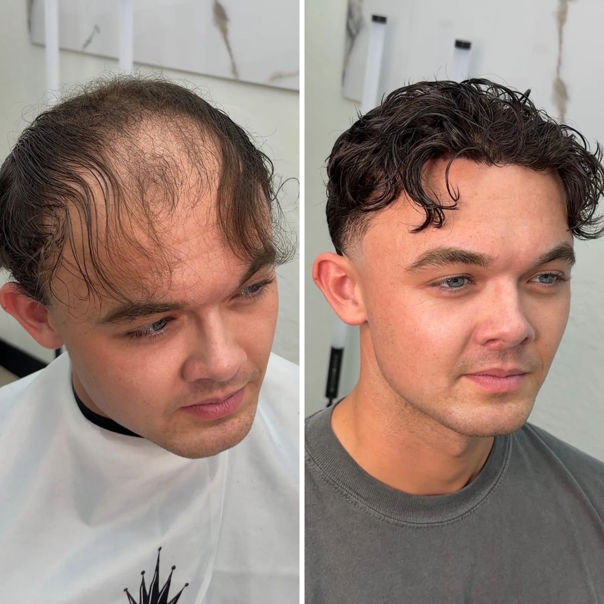 Before and after: a client with a receding hairline, then with a natural curly hairline after his hair replacement system was installed.