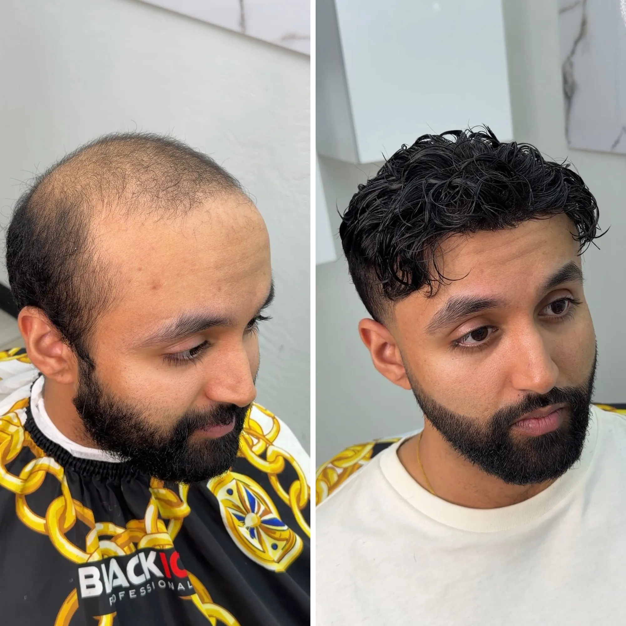 Before and after: a client with a thinning crown, then with dark curly hair, a fresh fade, and a lined-up beard after his install.
